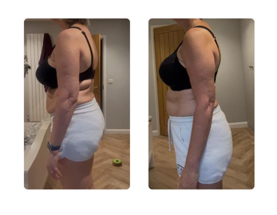 Female member back and side transformation