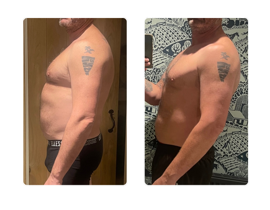 Male member side profile showing significant fat loss
