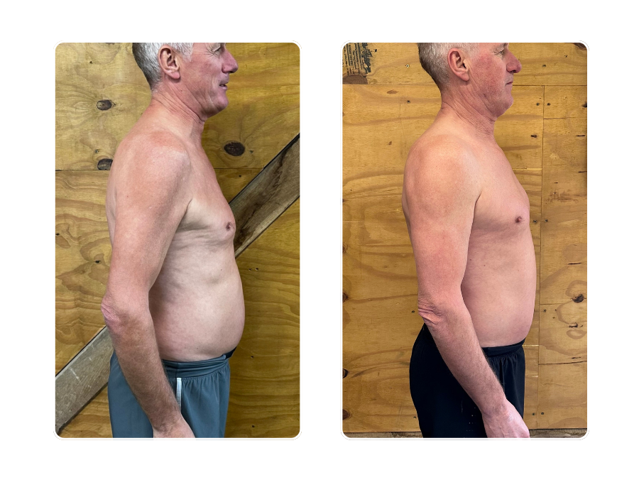 Older male member side profile showing belly reduction